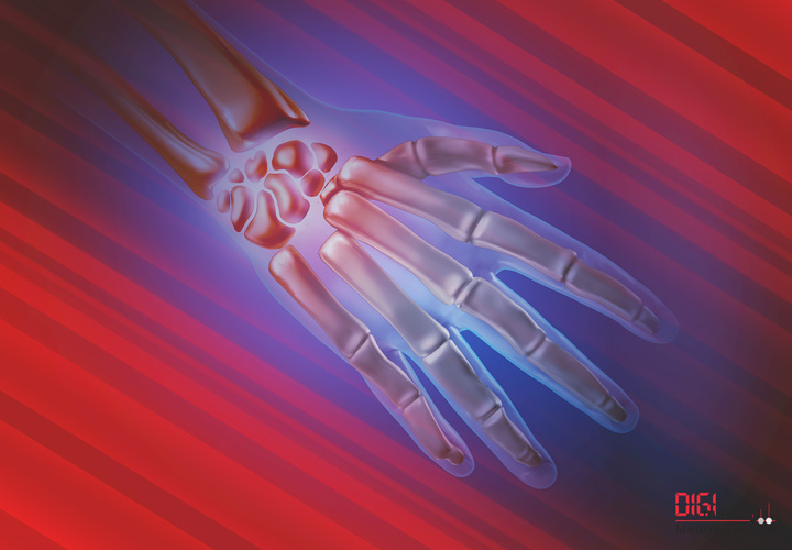 Handknochen Handknochen