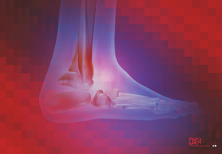 Fussknochen Fussknochen