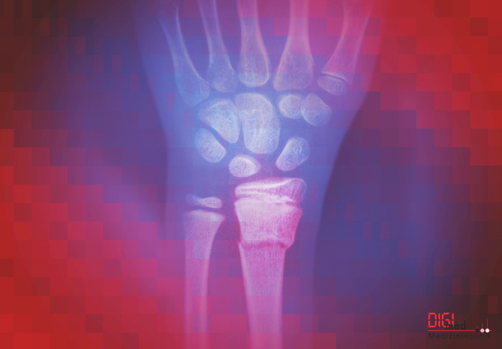 Handgelenk Handgelenk